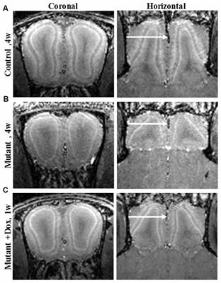 Manganese Enhanced MRI for Use in Studying Neurodegenerative Diseases